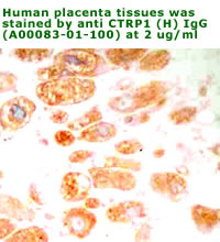 anti human CTRP1 antibody