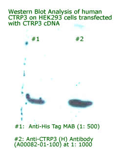 wetsrn blot analysis of CTRP3 on HEK293 cells