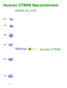 human CTRP6