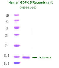 human GDf-15 recombinant