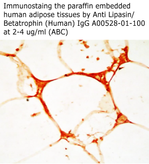 anti betatrophin antibody enables to stain human adipose tissues aviscera bioscience