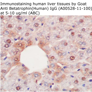 goat anti human betatrophin IgG A00528-11-100 enables to immunostain human samples from aviscera bioscience