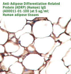anti ADRP antibody for IHC