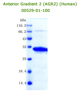 human AGR2 recombinant from aviscera bioscience
