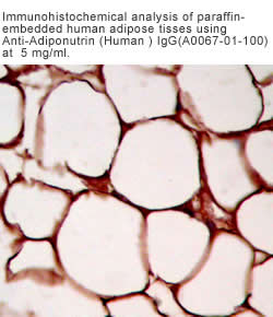 anti adiponutrin (human ) antibody