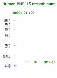 human BMP-15 recombinant