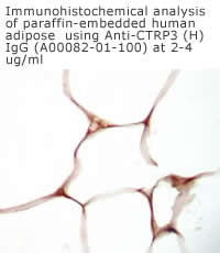 immunochemical staining human adipose tissues using anti human CTRP3 antibody