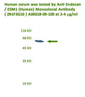 anti human endocan monoclonal antibody validated