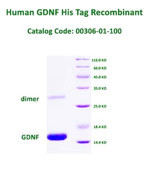 human gdnf recombinant