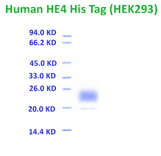 human HE4 recombinant protein