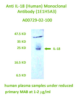 anti IL-18 monoclonal