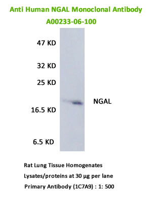 anti human NGAl Monoclonal antibody for western blot
