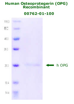 human OPG recombinant