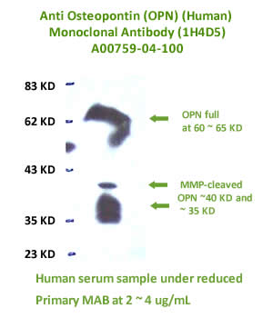 anti human OPN monoclonal antibody