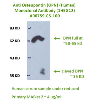 anti human OPN monoclonal antibody
