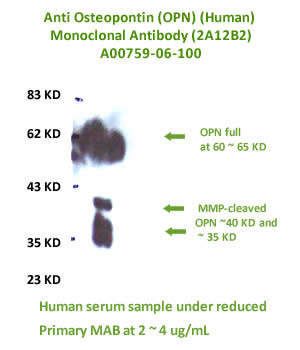 anti human OPN monoclonal antibody