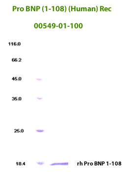 human Pro BNP1-108