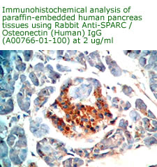 anti human osteonectin antibody