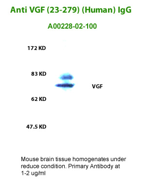 anti human VGF (23-279) antibody