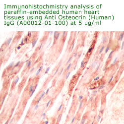 anti human osteocrin antibody for IHC