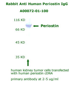 anti human periostin antibody