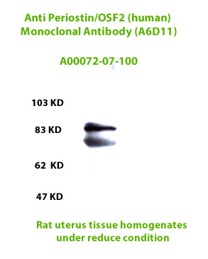 anti human periostin monoclonal antibody A6D11