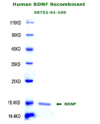 human bdnf recombinant from aviscera bioscience