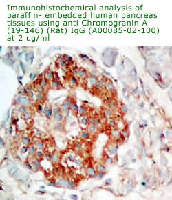 anti chromogranin A antibody for immunohistochemistry analysis