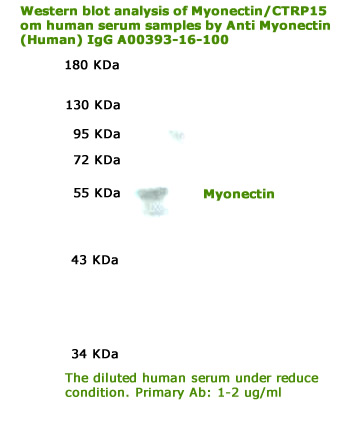 anti CTRP15 antibody was validated on western blot