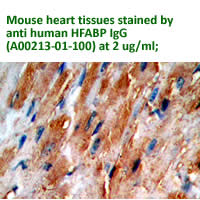 anti human HFABP antibody