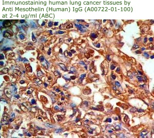 anti mesothelin antibody