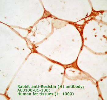 anti human resistin IgG
